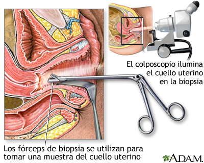 imag colpo
